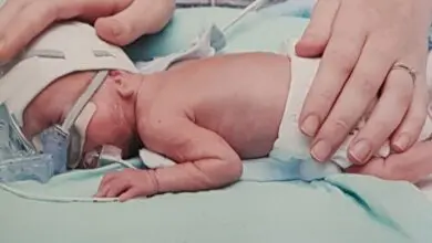 A Baby Weighing 1lb Fights the Odds to Make it to Her First Birthday