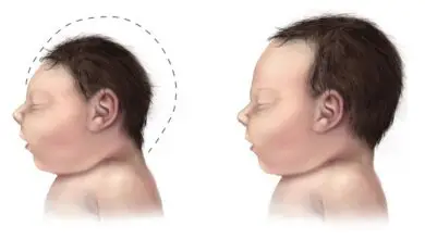 Puerto Rico Faced Several Zika-Affected Births