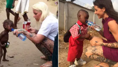 Toddler left to die by parents makes a stunning recovery