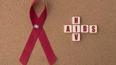 HIV Aids